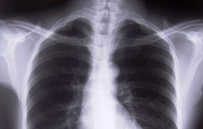 Zbadaj, co ci w płucach gra